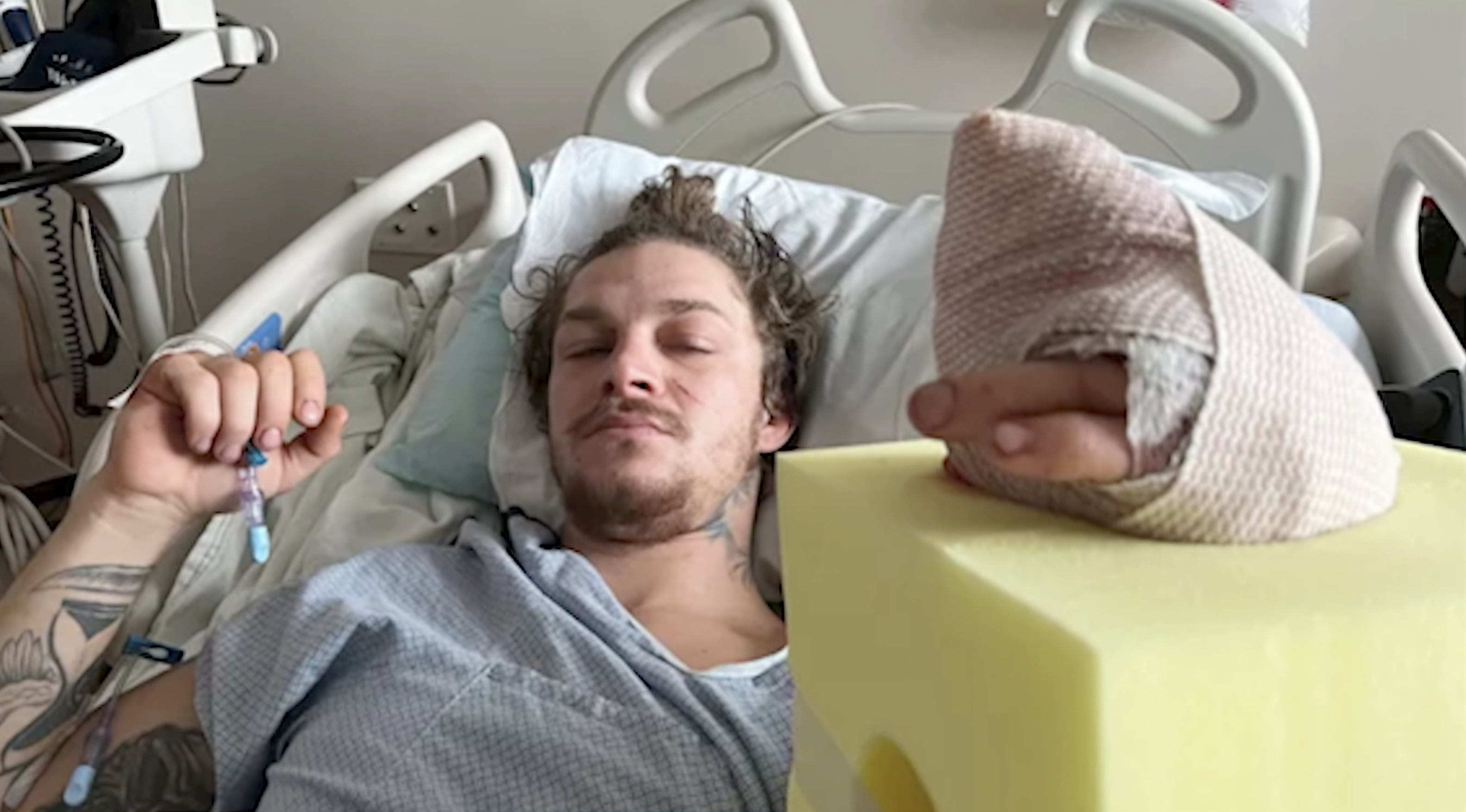 Bozeman man loses fingers in firework explosion - Vimarsana News